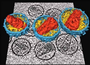 Electron micrograph of Human Immunodeficiency Virions.