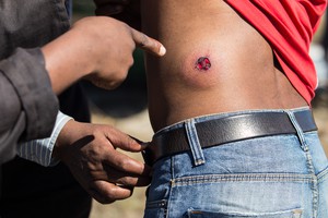 Evictions in Khayelitsha